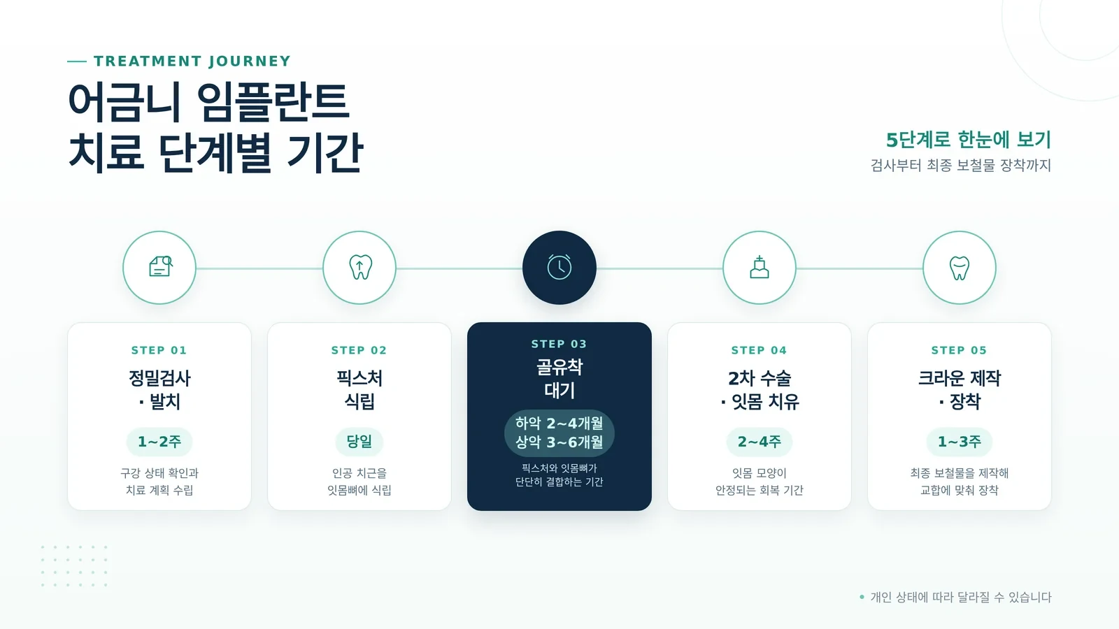 어금니 임플란트 과정 치료 단계 안내